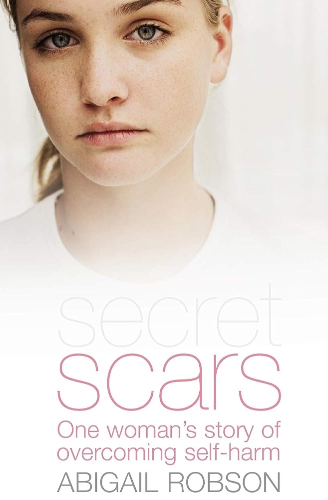 Secret Scars: One Woman's Story of Overcoming Self-Harm cover image